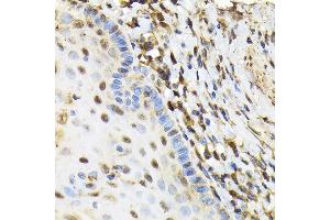 Immunohistochemistry of paraffin-embedded human esophageal using NRBF2 Rabbit pAb  at dilution of 1:100 (40x lens). (NRBF2 anticorps  (AA 10-220))