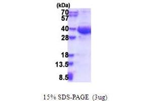 SDS-PAGE (SDS) image for Exosome Component 8 (EXOSC8) (AA 1-276) protein (His tag) (ABIN5853637)
