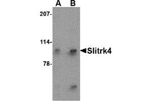 Western Blotting (WB) image for anti-SLIT and NTRK-Like Family, Member 4 (SLITRK4) (N-Term) antibody (ABIN1031578) (SLITRK4 anticorps  (N-Term))