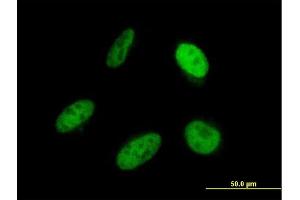 Immunofluorescence of monoclonal antibody to SRP68 on HeLa cell. (SRP68 anticorps  (AA 531-627))