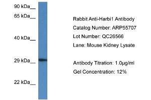 Western Blotting (WB) image for anti-Harbinger Transposase Derived 1 (HARBI1) (N-Term) antibody (ABIN2786327) (HARBI1 anticorps  (N-Term))