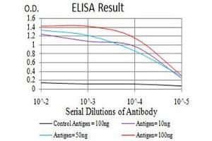 Black line: Control Antigen (100 ng),Purple line: Antigen (10 ng), Blue line: Antigen (50 ng), Red line:Antigen (100 ng)