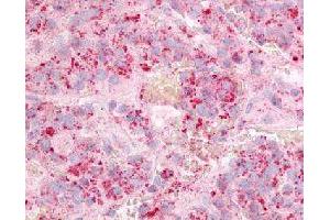 Immunohistochemical (Formalin/PFA-fixed paraffin-embedded sections) staining in human anterior pituitary with GPR12 polyclonal antibody . (G Protein-Coupled Receptor 12 anticorps)