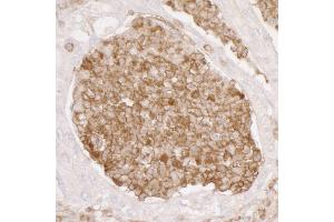 Immunohistochemistry (IHC) image for anti-Annexin A1 (ANXA1) (AA 1-50) antibody (ABIN7453913)