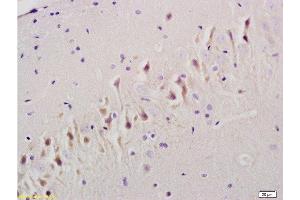 Formalin-fixed and paraffin embedded rat brain tissue labeled Anti-TGF Beta R1/TGFBR1 Polyclonal Antibody, Unconjugated  at 1:200, followed by conjugation to the secondary antibody and DAB staining