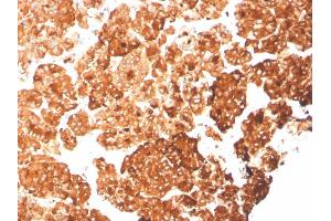 Formalin-fixed, paraffin-embedded human pancreas stained with KRT6A Recombinant Mouse Monoclonal Antibody (rKRT6A/2100). (Recombinant KRT6A anticorps)