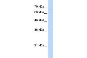 TKTL2 antibody used at 2. (TKTL2 anticorps  (C-Term))