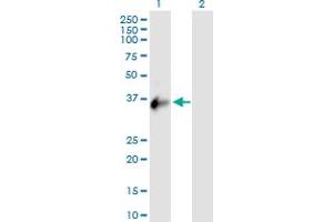 anti-Chromosome X Open Reading Frame 21 (CXorf21) (AA 1-301) antibody
