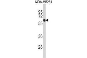 Western blot analysis of ANKRD13C Antibody (N-term) in MDA-MB231 cell line lysates (35µg/lane).
