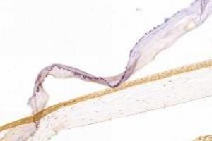 Immunohistochemistry analysis of paraffin-embedded rat eyeball using,Slc6a6 (ABIN7075842) at dilution of 1: 1000