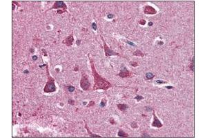 Immunohistochemistry (IHC) image for anti-14-3-3 theta (YWHAQ) (AA 1-245), (N-Term) antibody (ABIN336110)