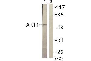 Immunohistochemistry analysis of paraffin-embedded human skeletal muscle tissue using Akt (Ab-129) antibody. (AKT1 anticorps  (Ser129))