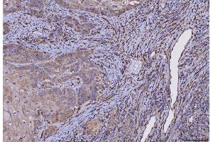 IHC analysis of HLA-DRA using anti-HLA-DRA antibody (ABIN7600949).