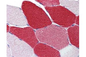 Immunohistochemistry (IHC) image for anti-Myosin Light Chain 6, Alkali, Smooth Muscle and Non Muscle (MYL6) (Middle Region) antibody (ABIN2787352)