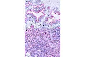 Immunohistochemical staining of formalin-fixed paraffin-embedded human prostate (A) and human spleen (B) with GPR63 polyclonal antibody . (GPR63 anticorps  (Extracellular Domain))