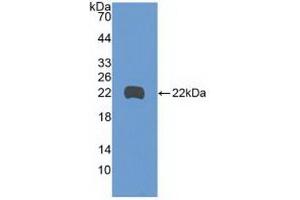 Western blot analysis of recombinant Human GADD45b. (GADD45B anticorps  (AA 1-160))