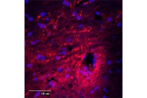 IF (confocal) on rat brain at a concentration of 30 µg/ml using Rabbit antibody to MAP2 , DAPI counterstained appearing in blue. (MAP2 anticorps  (AA 350-400))