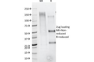 SDS-PAGE Analysis Purified CD79b Mouse Monoclonal Antibody (IGB/1844). (CD79b anticorps  (AA 29-159))