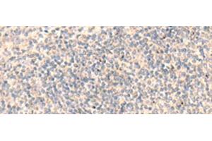 Immunohistochemistry of paraffin-embedded Human tonsil tissue using ADAMTS2 Polyclonal Antibody at dilution of 1:45(x200) (Adamts2 anticorps)