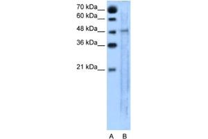 Western Blotting (WB) image for anti-Solute Carrier Family 25, Member 46 (SLC25A46) antibody (ABIN2462775) (SLC25A46 anticorps)