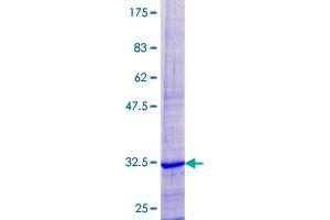 Image no. 1 for Cytochrome C Oxidase Subunit VIIIC (COX8C) (AA 1-72) protein (GST tag) (ABIN1350162)