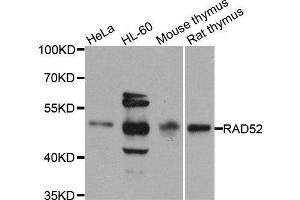 Western blot analysis of extracts of various cell lines, using RAD52 antibody. (RAD52 anticorps  (AA 125-418))