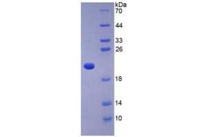 SDS-PAGE analysis of Human Adiponectin Protein.