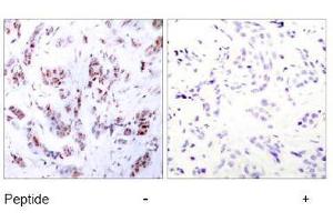 Image no. 2 for anti-Myocyte Enhancer Factor 2A (MEF2A) (Thr312) antibody (ABIN197165) (MEF2A anticorps  (Thr312))