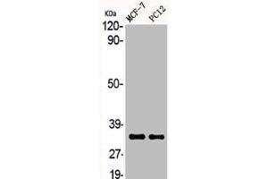 Western Blot analysis of MCF7 PC-12 cells using ACOT8 Polyclonal Antibody (ACOT8 anticorps  (Internal Region))