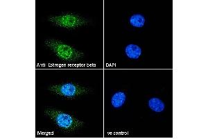 ABIN5539801 Immunofluorescence analysis of paraformaldehyde fixed HeLa cells, permeabilized with 0. (ESR2 anticorps  (AA 417-428))