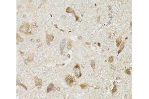 Immunohistochemistry of paraffin-embedded Mouse brain using NDUFS7 Polyclonal Antibody at dilution of 1:100 (40x lens).