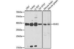 Western blot analysis of extracts of various cell lines, using RNF2 antibody.