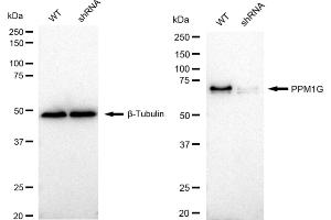 Western blotting analysis using PPM1G antibody (ABIN7800035).