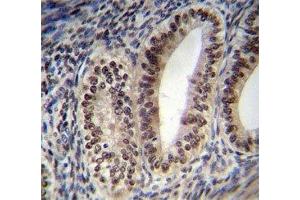 Progesterone Receptor antibody immunohistochemistry analysis in formalin fixed and paraffin embedded human uterus tissue.