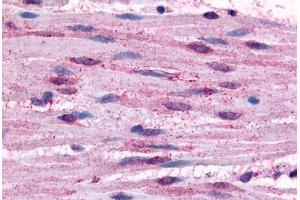 anti-Adrenergic, alpha-1B-, Receptor (ADRA1B) (Cytoplasmic Domain) antibody