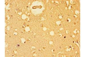 Immunohistochemistry of paraffin-embedded human brain tissue using ABIN7152184 at dilution of 1:100 (EIF4E anticorps  (AA 2-217))