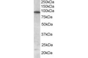 Image no. 1 for anti-Forkhead Box O3 (FOXO3) (C-Term) antibody (ABIN374440) (FOXO3 anticorps  (C-Term))