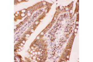 Anti-RUNX1/AML1 Picoband antibody ,  IHC(P): Mouse Intestine Tissue