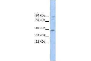 WB Suggested Anti-TMC8 Antibody Titration: 0.