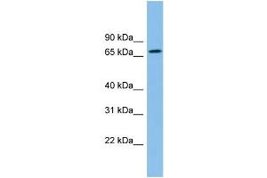 WB Suggested Anti-ZNF182 Antibody Titration: 0. (ZNF182 anticorps  (Middle Region))