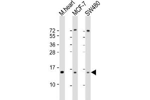 All lanes : Anti-NDUFA7 Antibody (C-Term) at 1:2000 dilution Lane 1: mouse heart lysate Lane 2: MCF-7 whole cell lysate Lane 3: S whole cell lysate Lysates/proteins at 20 μg per lane. (NDUFA7 anticorps  (AA 80-110))