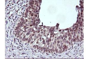Image no. 1 for anti-Cancer/testis Antigen 1B (CTAG1B) antibody (ABIN1499894) (CTAG1B anticorps)