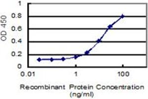 Detection limit for recombinant GST tagged KIAA1217 is 0.