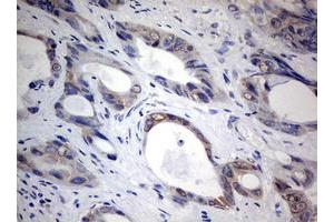 Image no. 1 for anti-TIA1 Cytotoxic Granule-Associated RNA Binding Protein (TIA1) antibody (ABIN1501387) (TIA1 anticorps)