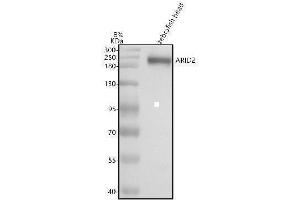 Western blot analysis of ARID2 using anti-ARID2 antibody (AZA0JPE6).