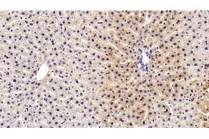 Detection of ALT in Rat Liver Tissue using Polyclonal Antibody to Alanine Aminotransferase (ALT)
