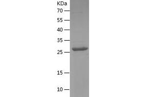 Western Blotting (WB) image for Aquaporin 1 (Colton Blood Group) (AQP1) (AA 208-269) protein (His-IF2DI Tag) (ABIN7121880)