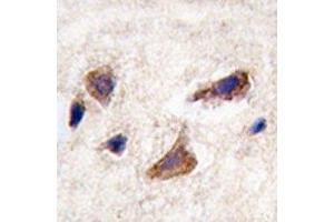 IHC analysis of FFPE human brain tissue stained with CAMKK2 antibody