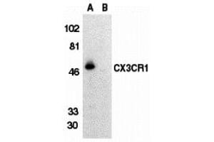Western Blotting (WB) image for anti-Chemokine (C-X3-C Motif) Receptor 1 (CX3CR1) (Extracellular Loop) antibody (ABIN1030840) (CX3CR1 anticorps  (Extracellular Loop))