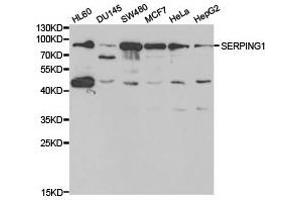 Western Blotting (WB) image for anti-Serpin Peptidase Inhibitor, Clade G (C1 Inhibitor), Member 1 (SERPING1) antibody (ABIN1874741) (SERPING1 anticorps)